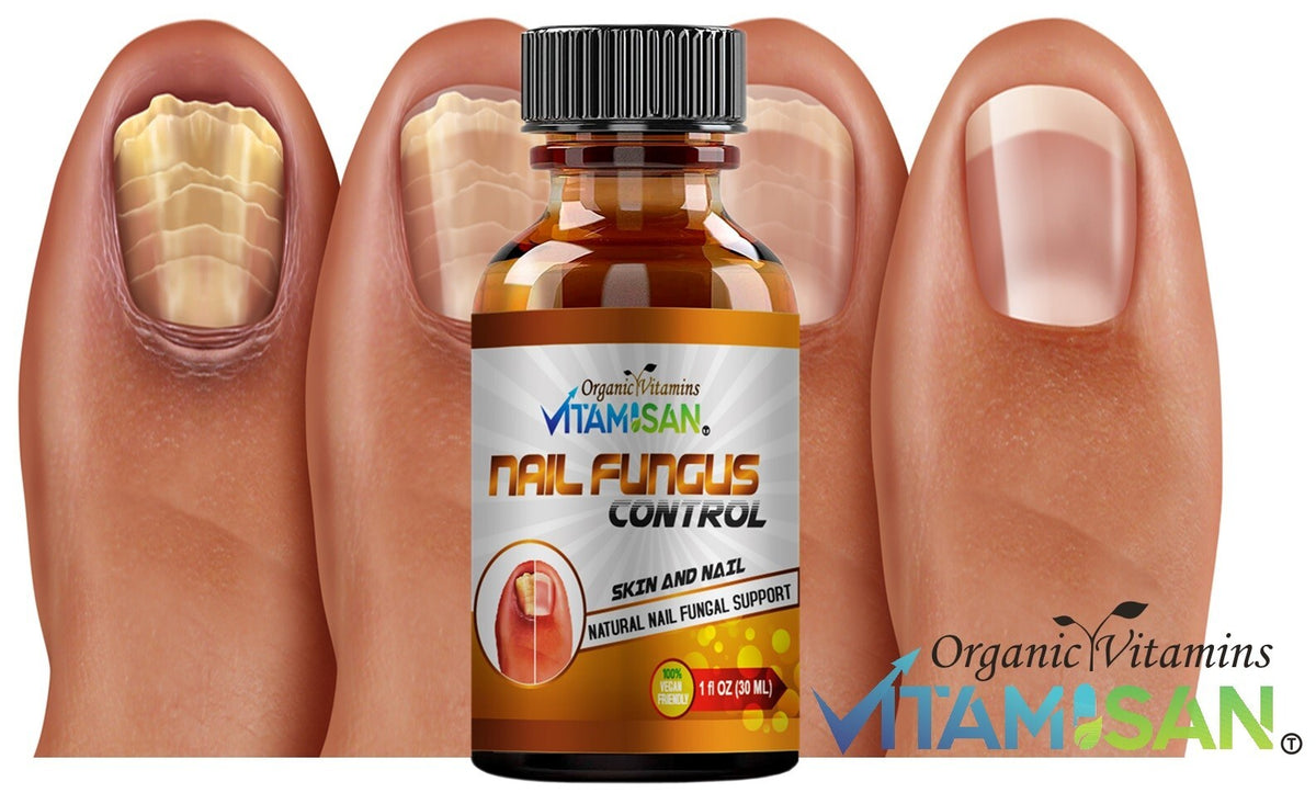 Antifungal Liquid Brush for Toenail Fungus - Max Strength 30ml