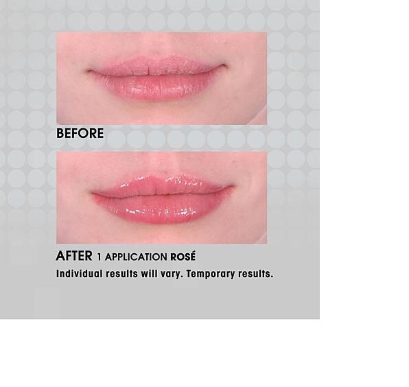Skincare & Lip Treatment Set - Trial Sizes with SPF 30 & Volumizing Serum
