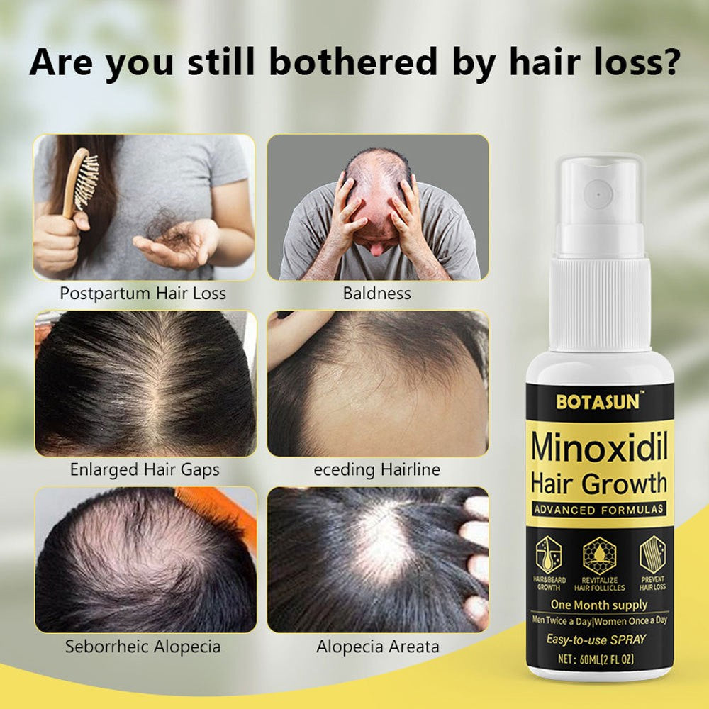 5% Minoxidil Hair Regrowth Spray - 60ml