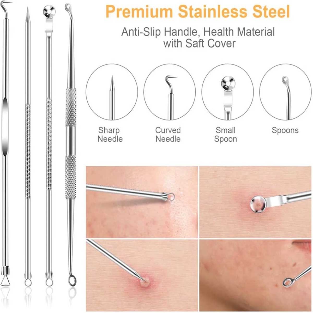 9-Piece Blackhead Remover Tool Kit for Comedone Extraction - Stainless Steel