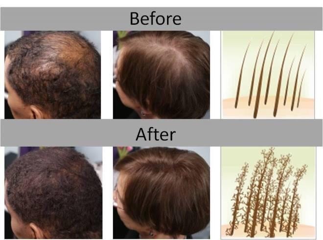Dark Brown Hair Building Fibers Keratin Powder
