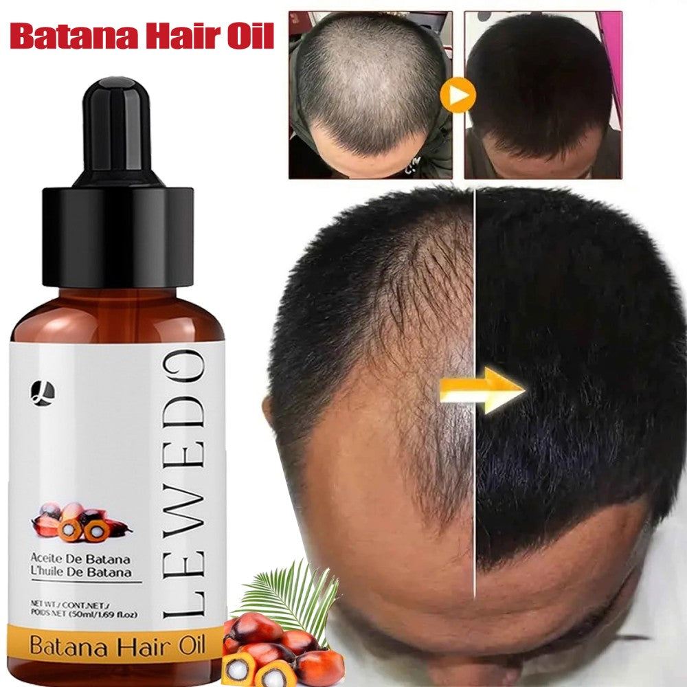 Anti Hair Loss Shampoo 200ml with Herbal Extracts