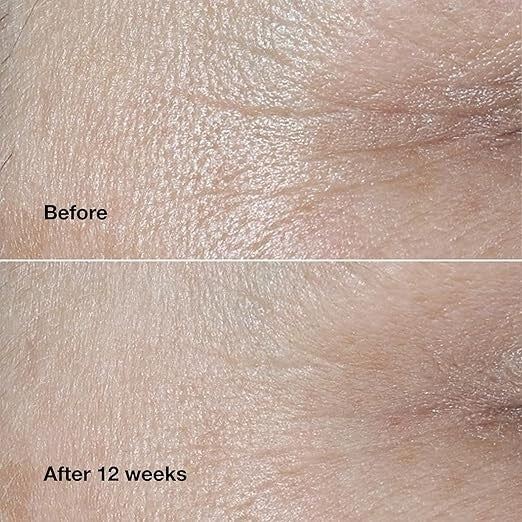 Clinique Smart Clinical Repair Wrinkle Correcting Face Cream with Hyaluronic Acid – Travel Size