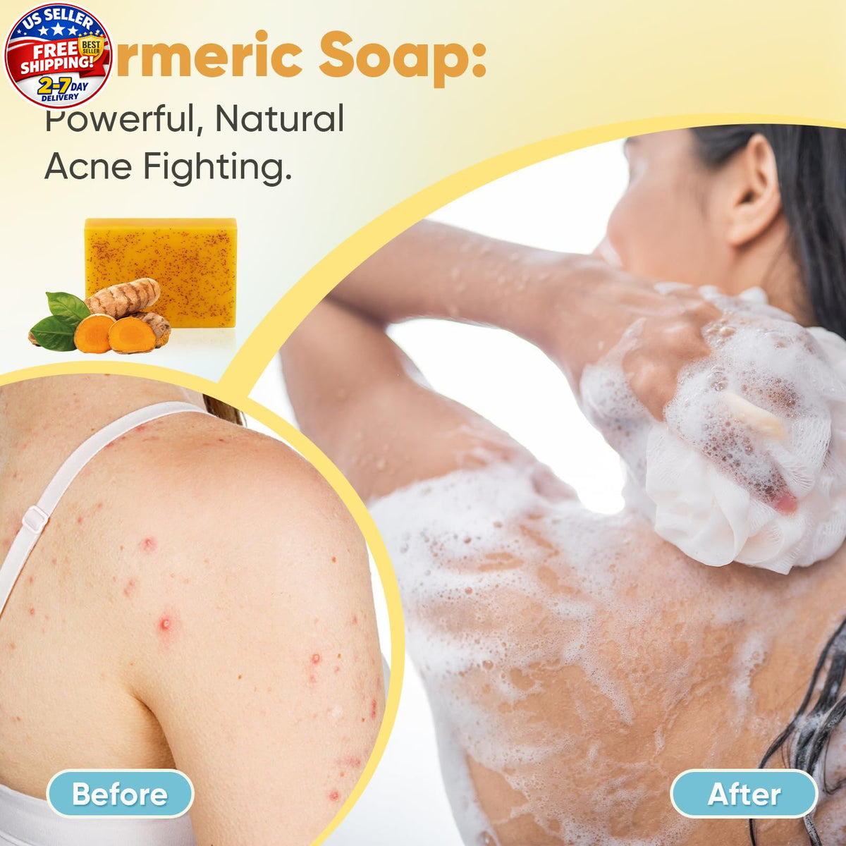 Turmeric Kojic Acid Soap Bar 80g – 5 Pack for Dark Spots Face & Body