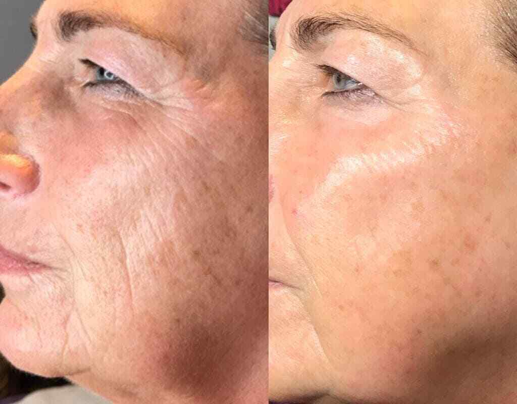 Anti-Aging Peptide Serum with Argireline Hyaluronic Acid Collagen