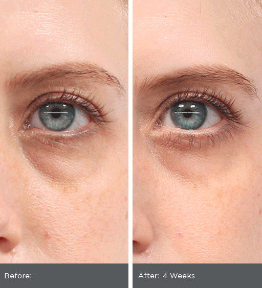 Peptide Eye Serum with Hyaluronic Acid & Vitamin C for Dark Circles & Wrinkles