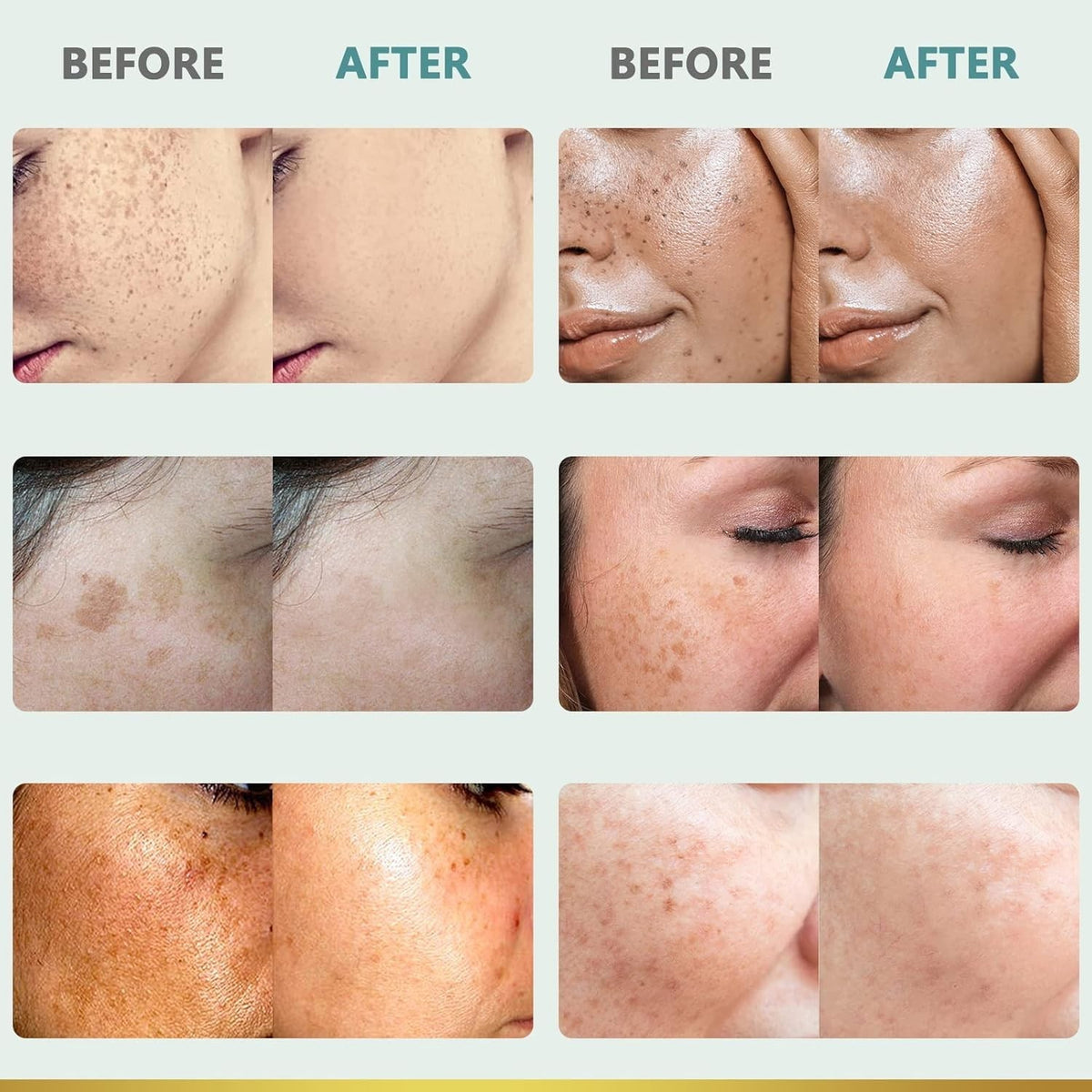 Dark Spot Corrector Cream for Hyperpigmentation & Uneven Skin Tone - 1.7 OZ
