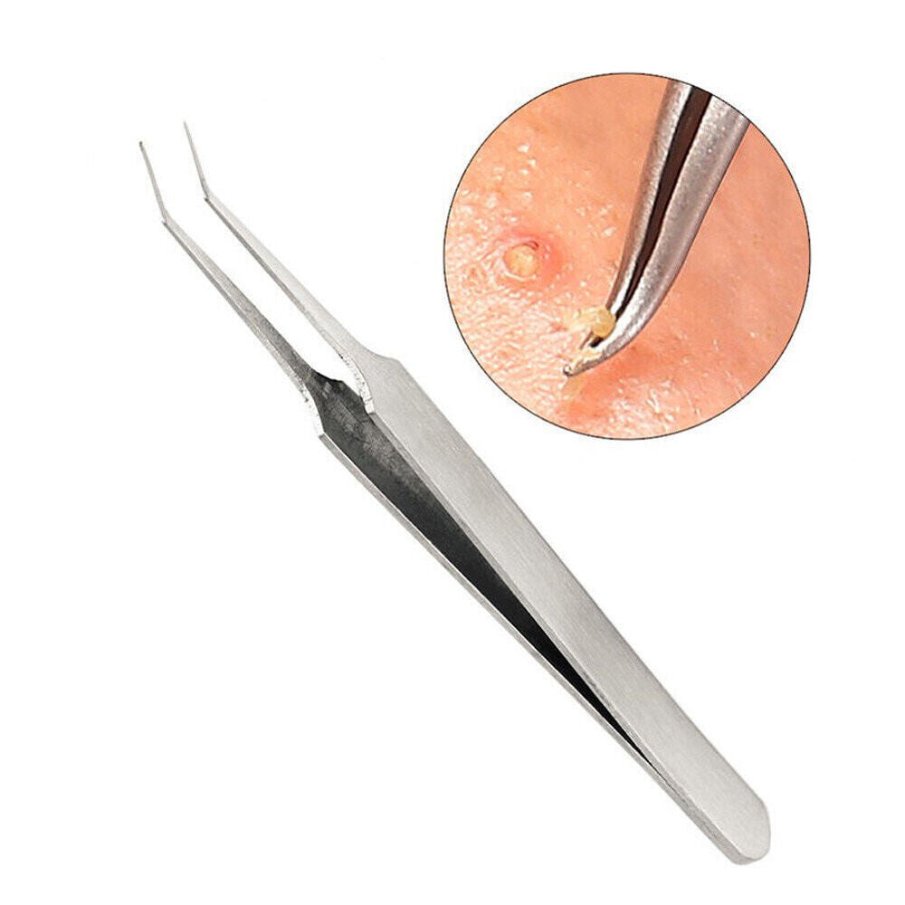 Blackhead Remover Tweezers Set - Pimple Blemish Extraction Tools