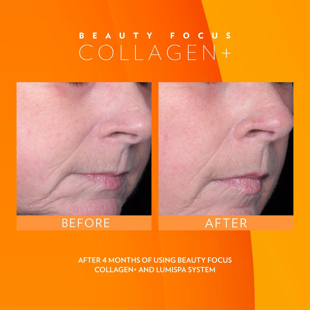 Liquid Collagen Drink for Skin Radiance and Anti-Aging - Peach Flavor, 30 Days Supply