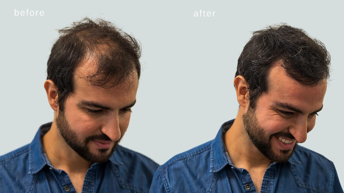 Hair Building Fibers, Volumizing Keratin Thinning Hair, Loss