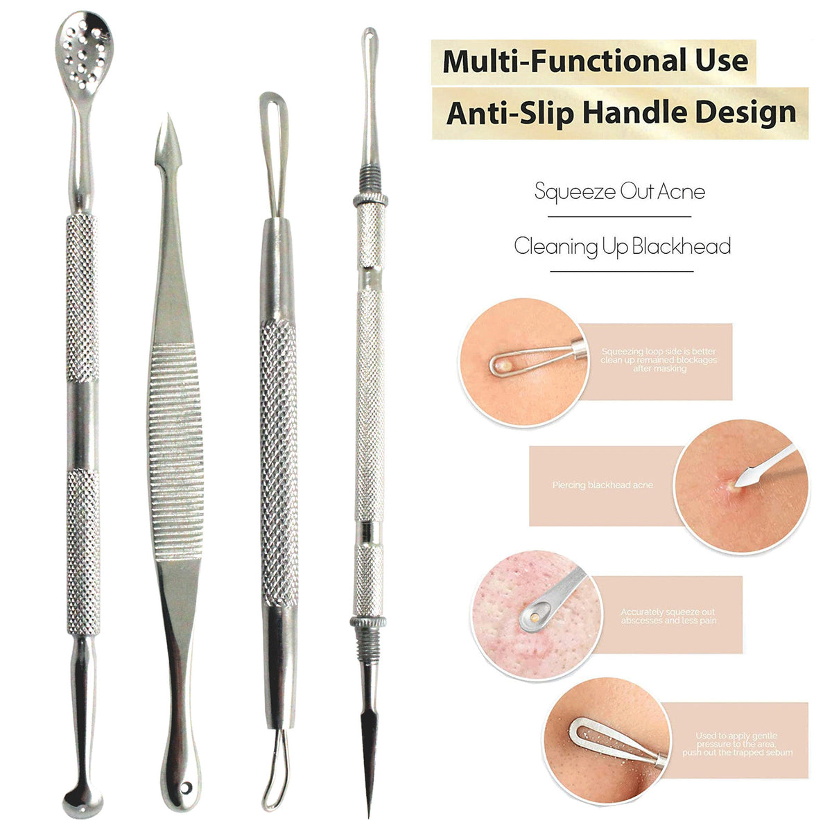 Stainless Steel Blackhead Remover Tools Kit - 4 Piece Acne Extraction Set