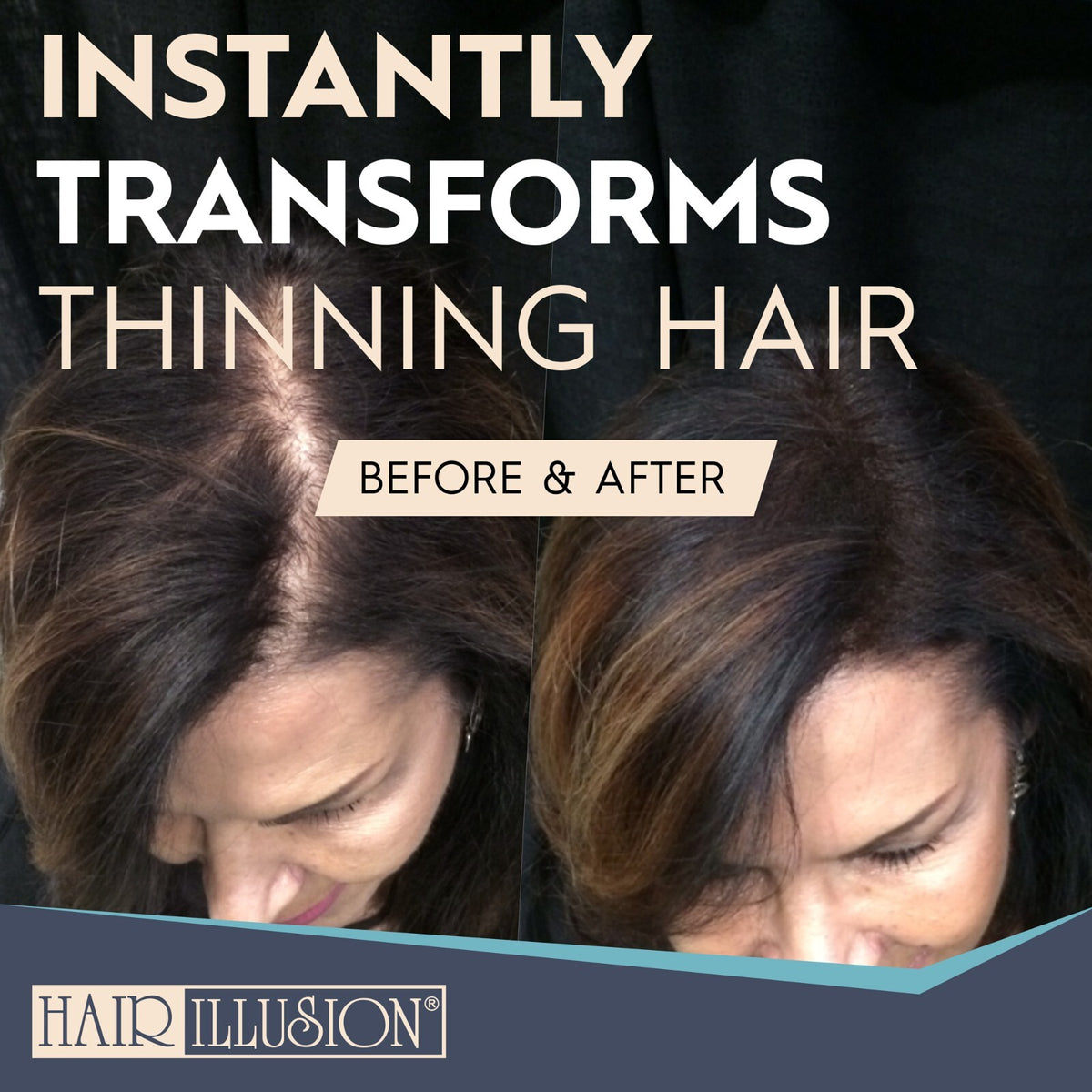 Keratin Hair Fibers for Bald Spot & Hair Loss Concealer