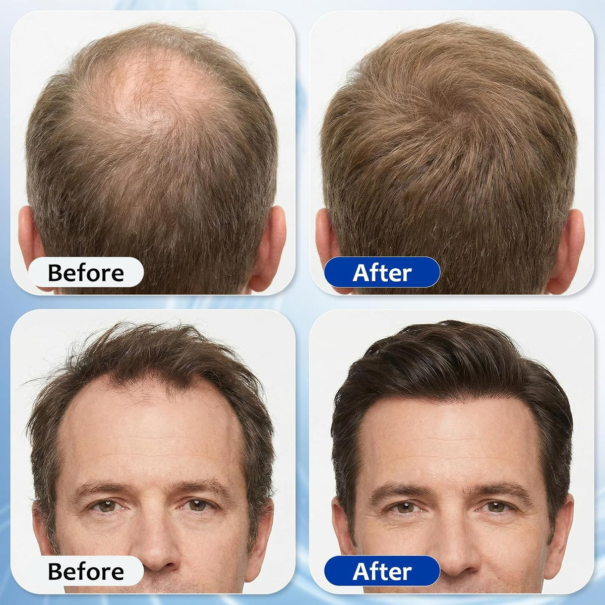 Hair Growth Serum Roll On with 3% Rosemary Bataua Oil 2% Pea Extract