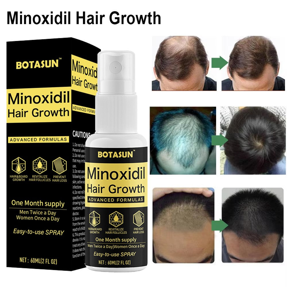 Minoxidil 5% Spray Men Hair Regrowth Treatment Solution 1 Month