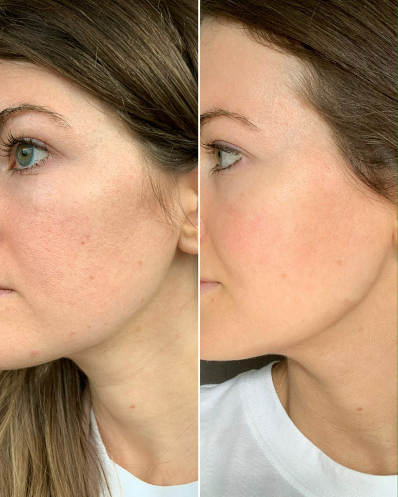 Retinol Serum Moisturizer with Hyaluronic Acid