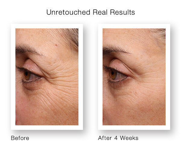 Pure Retinol Vitamin A Serum with Hyaluronic Acid - Anti-Aging Skin Care
