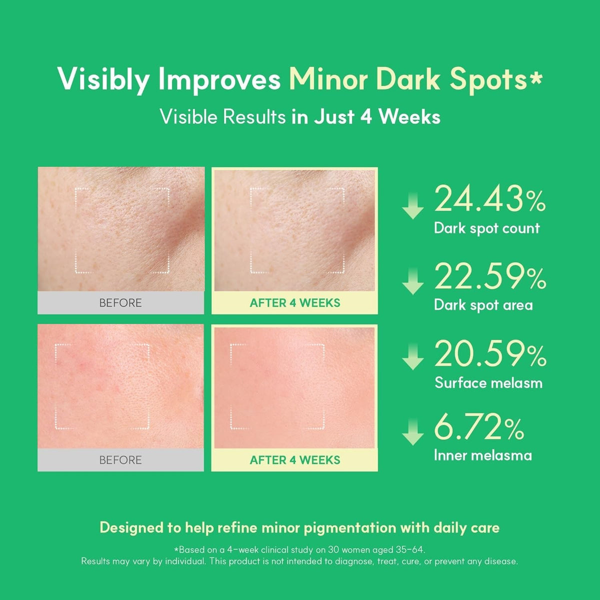 Dark Spot Serum with EGF & Niacinamide - Anti-Aging, Firming & Brightening Facial Treatment 0.27 Fl Oz