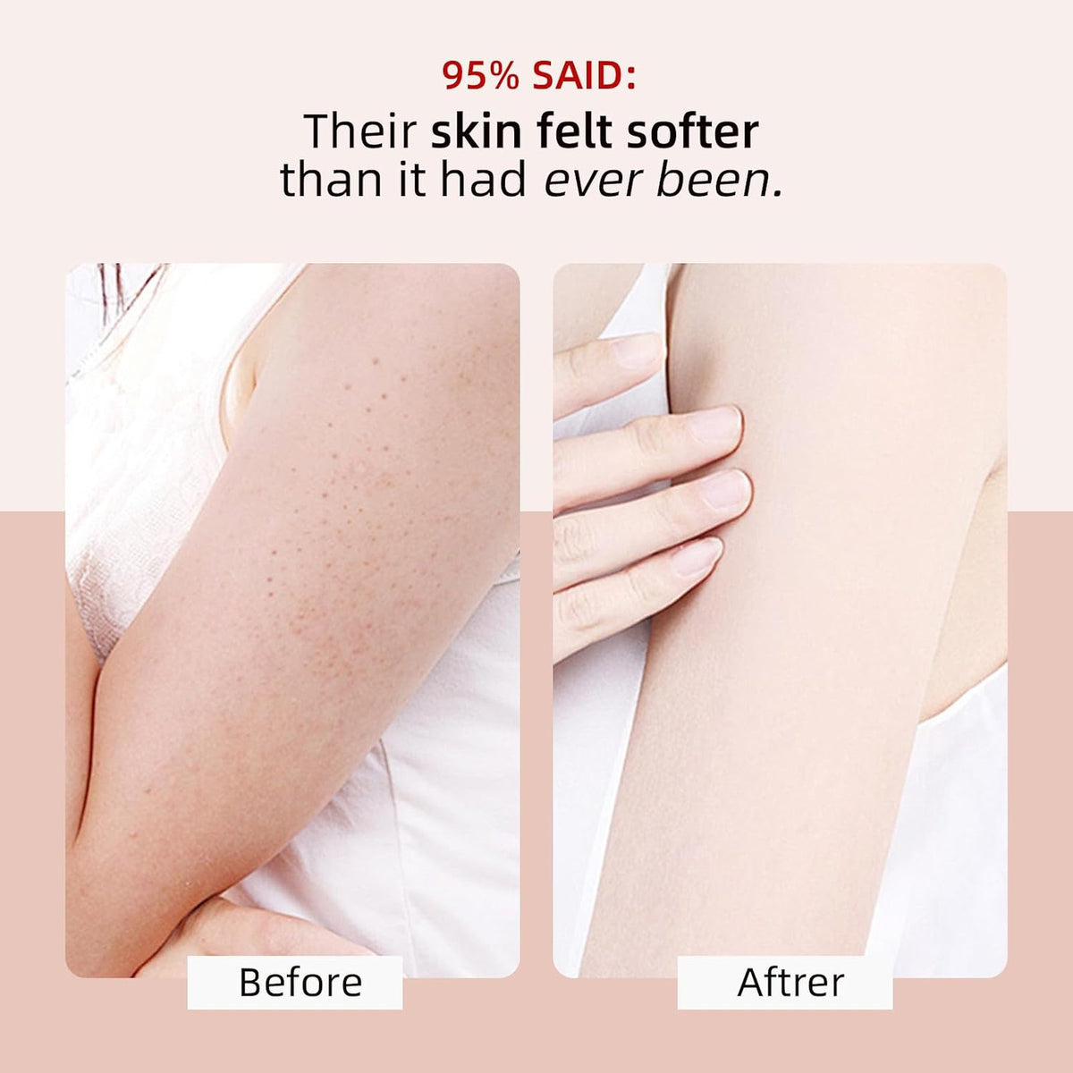 Bump Eraser Body Scrub 10 AHA BHA Exfoliating Treatment for Ingrown