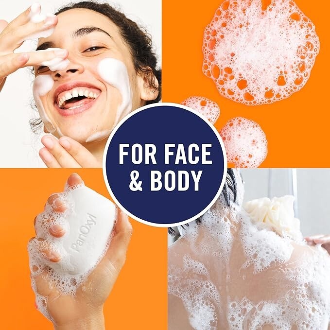 Acne Treatment Bar with 10% Benzoyl Peroxide - Deep Cleansing Pore Minimizer
