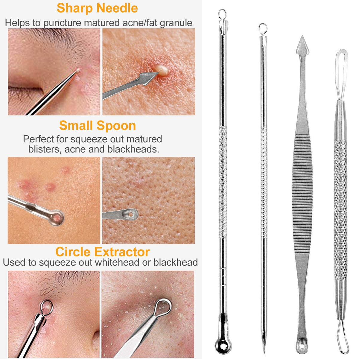 7Pcs Blackhead Remover Kit Stainless Steel Comedone Acne Extractor Tools