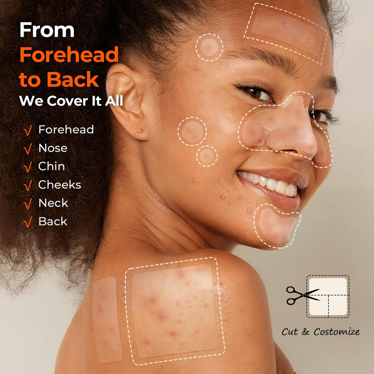 Hydrocolloid Acne Patches, 6 Sizes, 356 Count