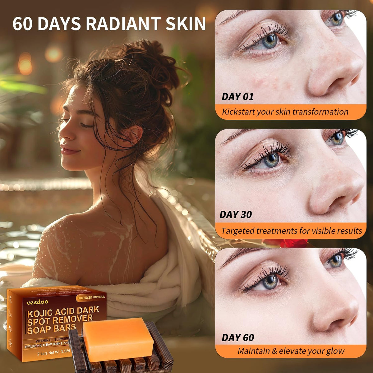 ceedoo Kojic Acid Soap for Dark Spot Remover Bars with 3.5 Ounce