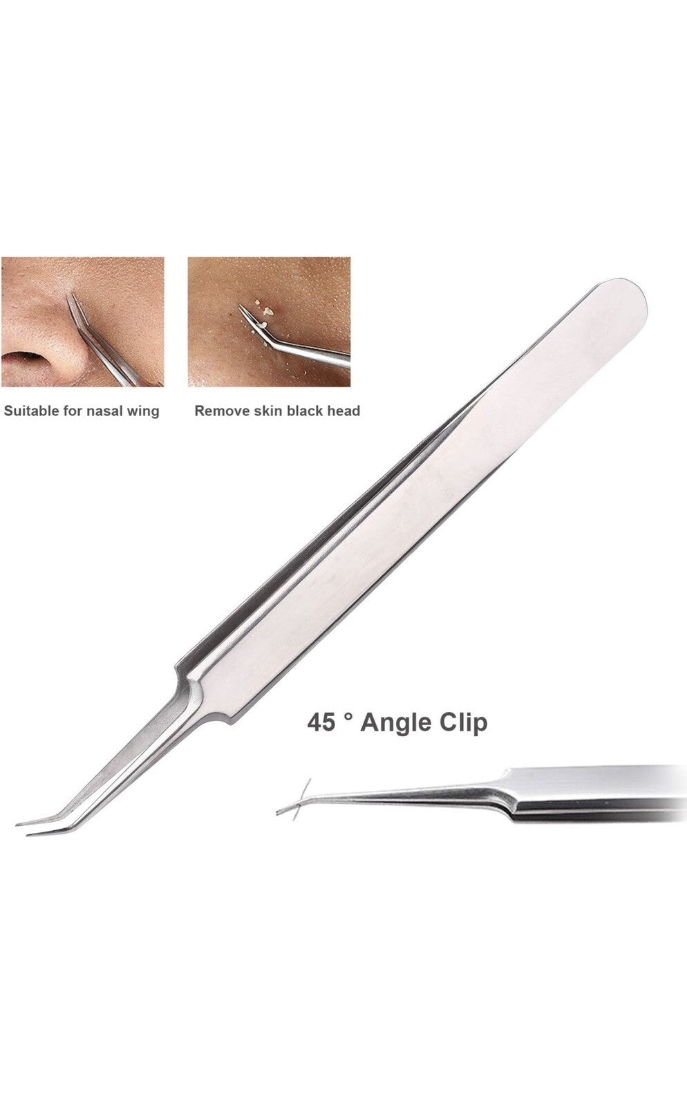 3-Piece Blackhead Remover Kit - Pimple & Acne Extraction Tools Set