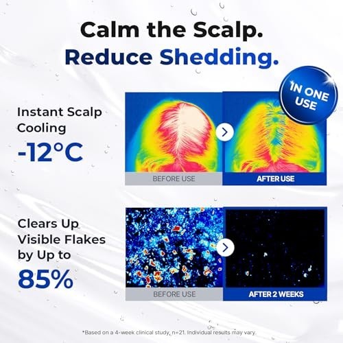 Scalp Serum 150ml with 38-Tip Comb Applicator