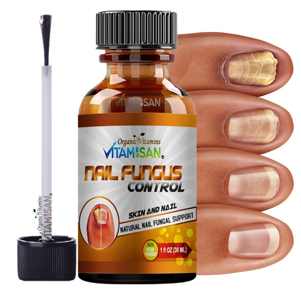 Anti-Fungal Nail Fungus Treatment Kit with Brush & Liquid - Supports Healthy Nails