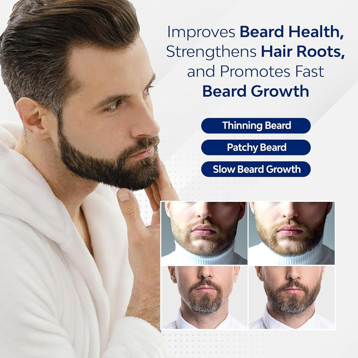 5% Minoxidil Hair Growth Serum for Men and Women 30mL