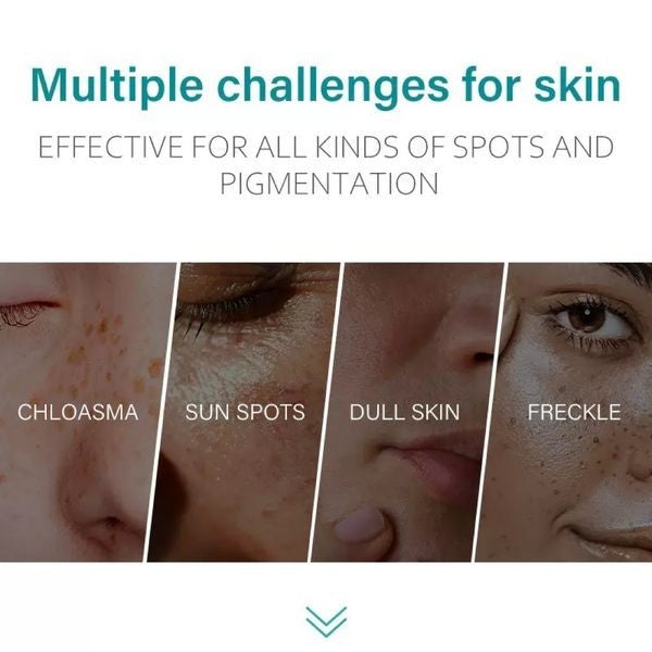 Dark Spot Remover Cream for Face & Body - Anti-Aging & Hyperpigmentation Treatment - 2 Pack