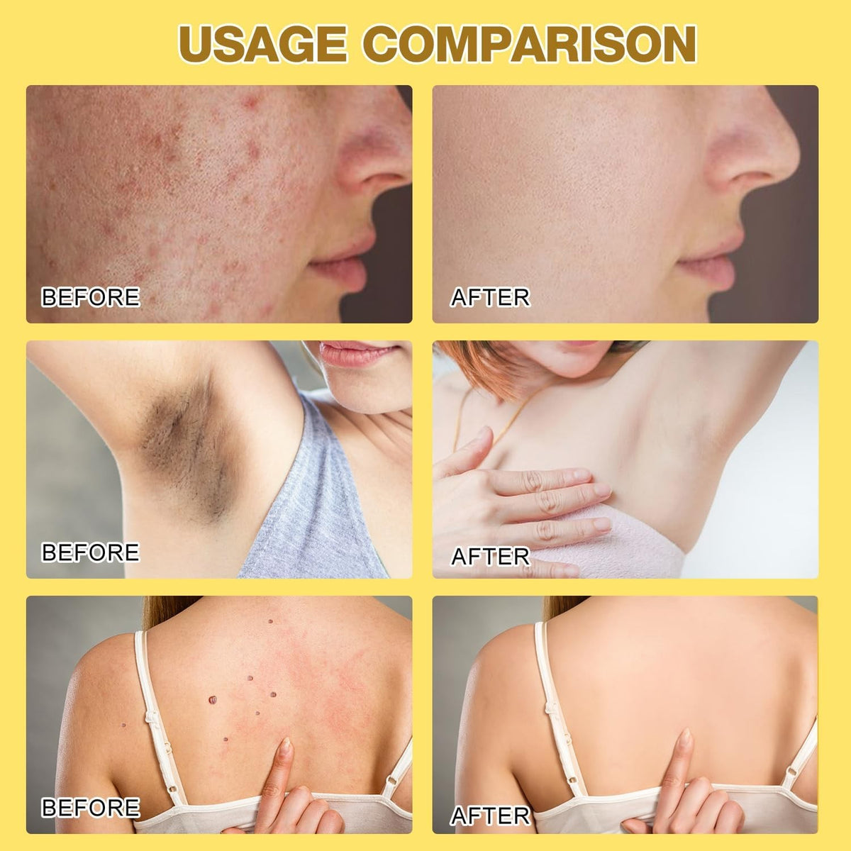 Bee Venom Treatment Cream Pack - Natural Skin Repair for All Body Parts