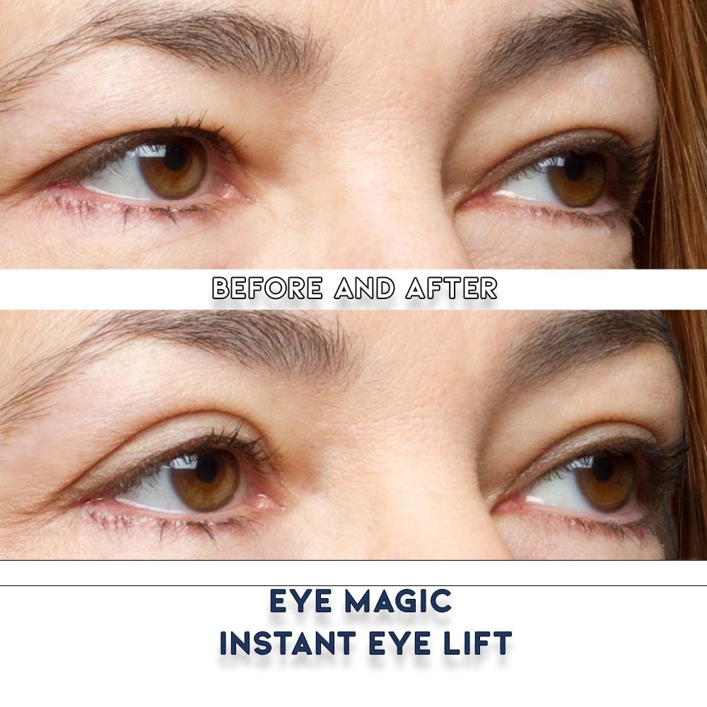 Premium Eye Lift Strips for Hooded & Droopy Eyelids - Rejuvenate & Brighten