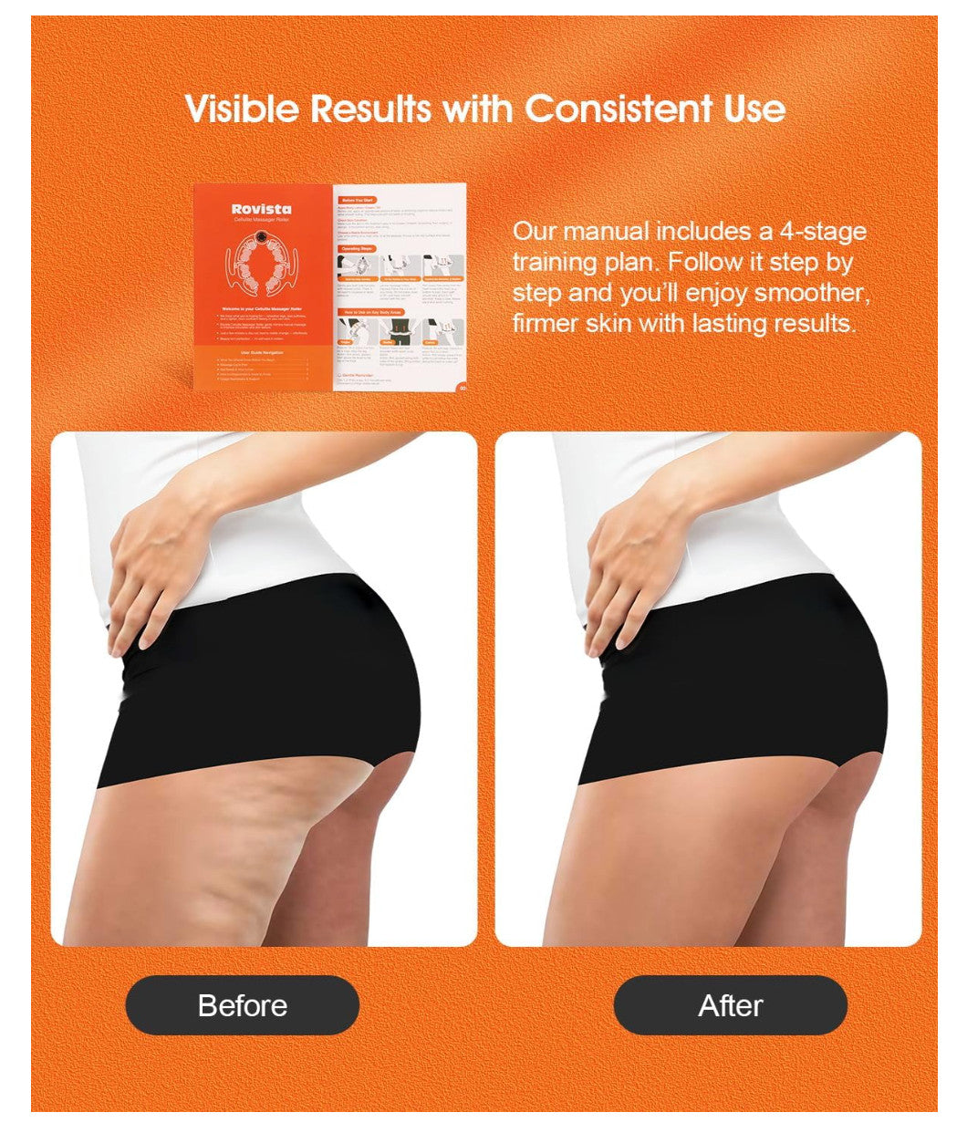 Anti-Cellulite Massage Roller for Lymphatic Drainage - Body Contouring Tool