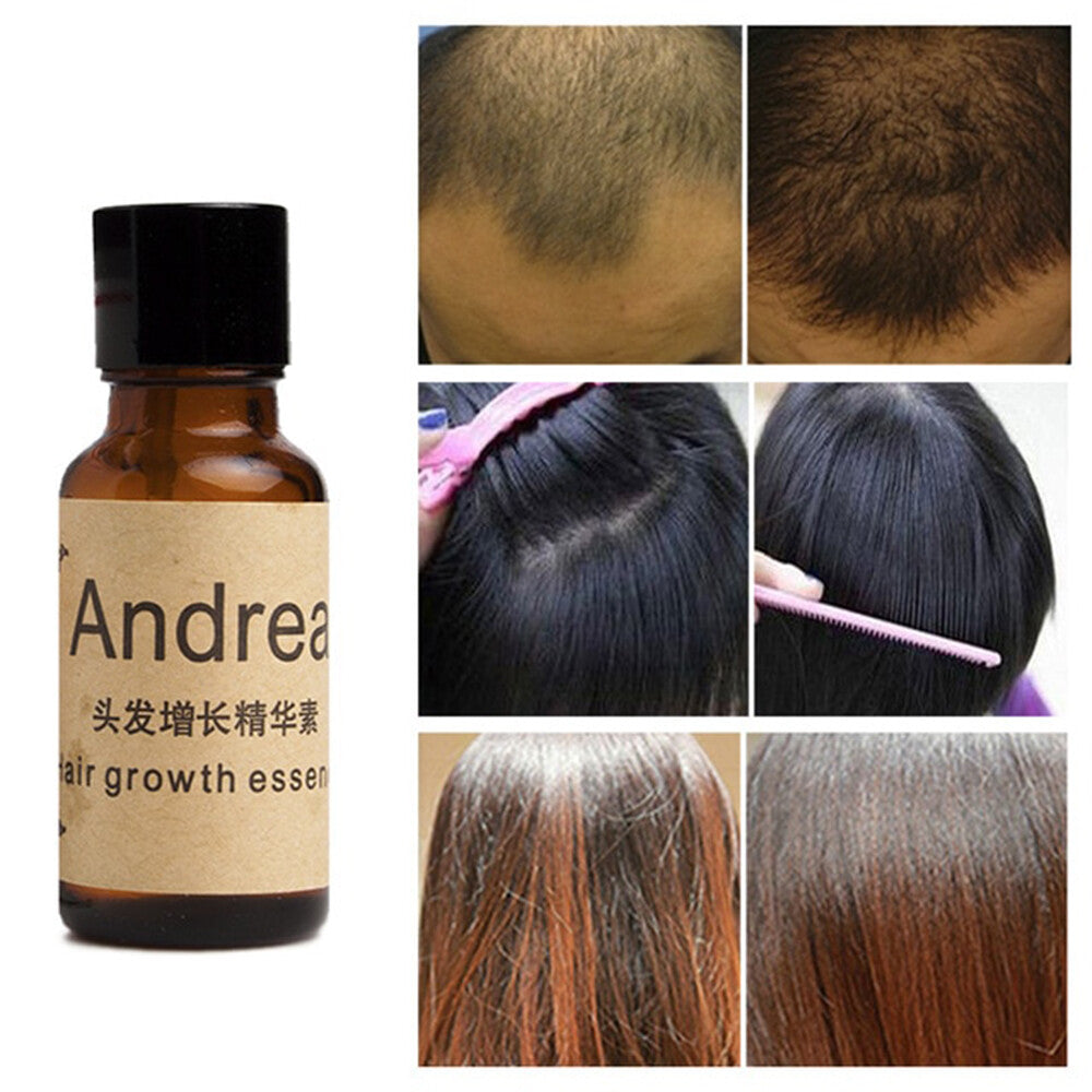 Natural Hair Loss Treatment Oil - Stop Hair Fall, Restore Volume