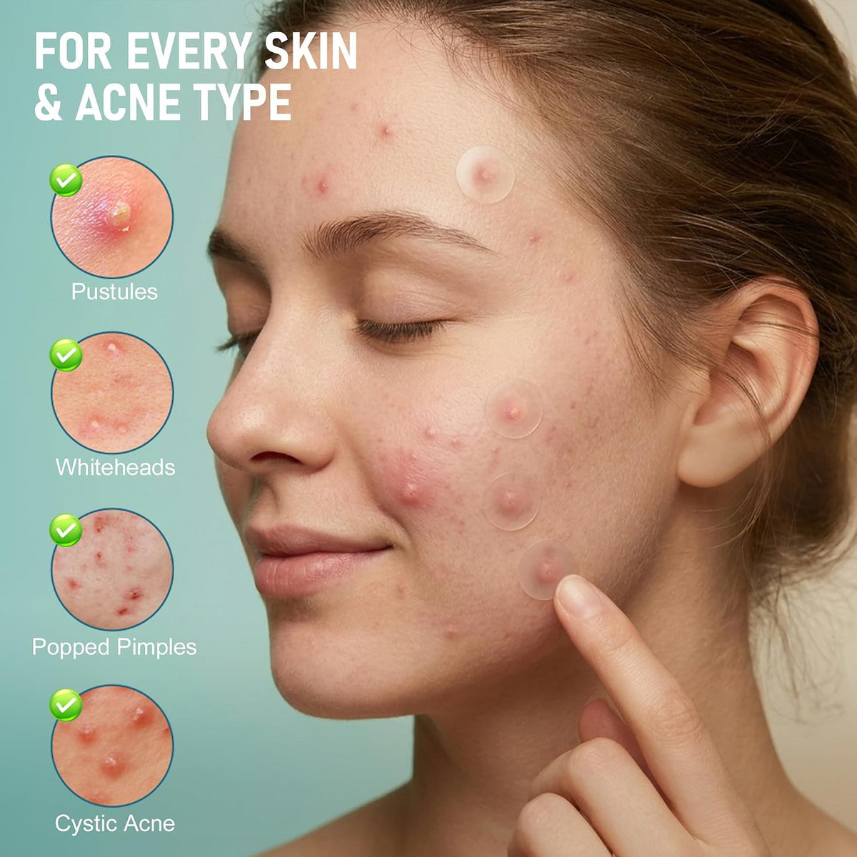 Hydrocolloid Acne Patches Set - 1250 Clear Facial Blemish Cover