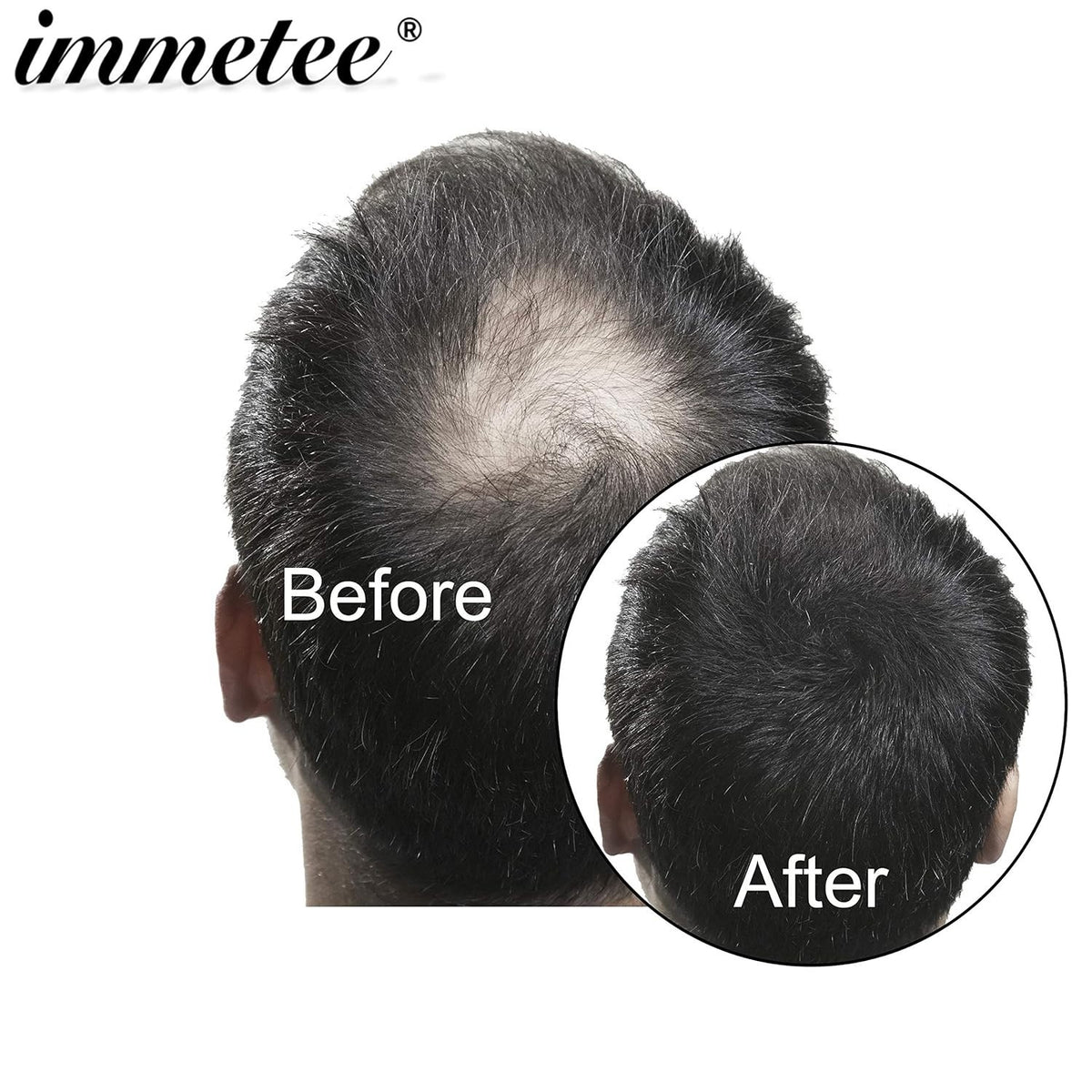 Hair Building Fibers Powder - Grey, 28g