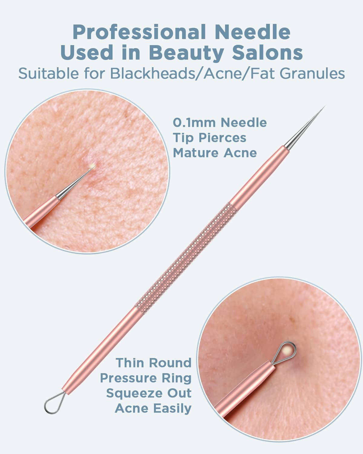 Blackhead Remover Tool Kit - Rose Gold 5-Piece Skin Care Set for Clear Complexion