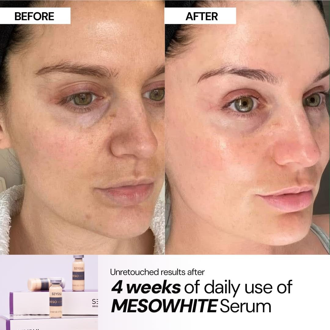Brightening Serum for Dark Spots - Hydrating & Radiance Boost, Pack of 6