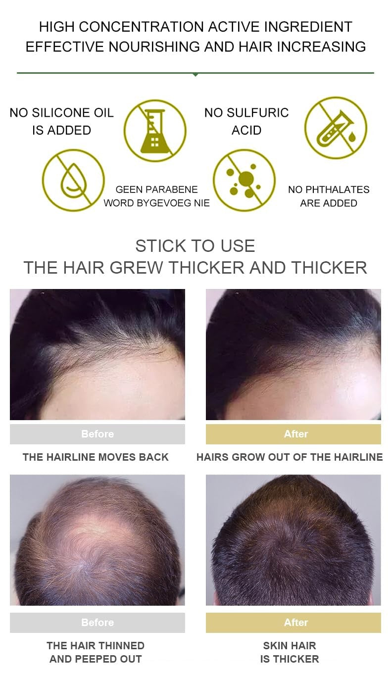 Hair Growth Serum with Ginger Oil and Biotin for Thinning Hair - Natural & Fast Results