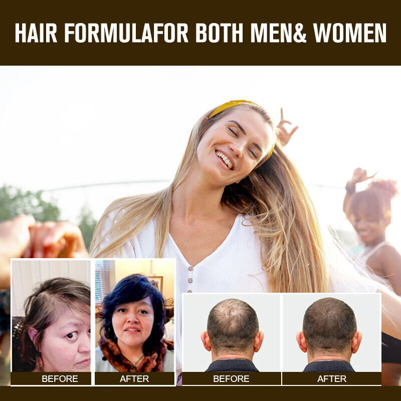 Hair Growth Herbal Supplement Pills - 5000mg Capsules