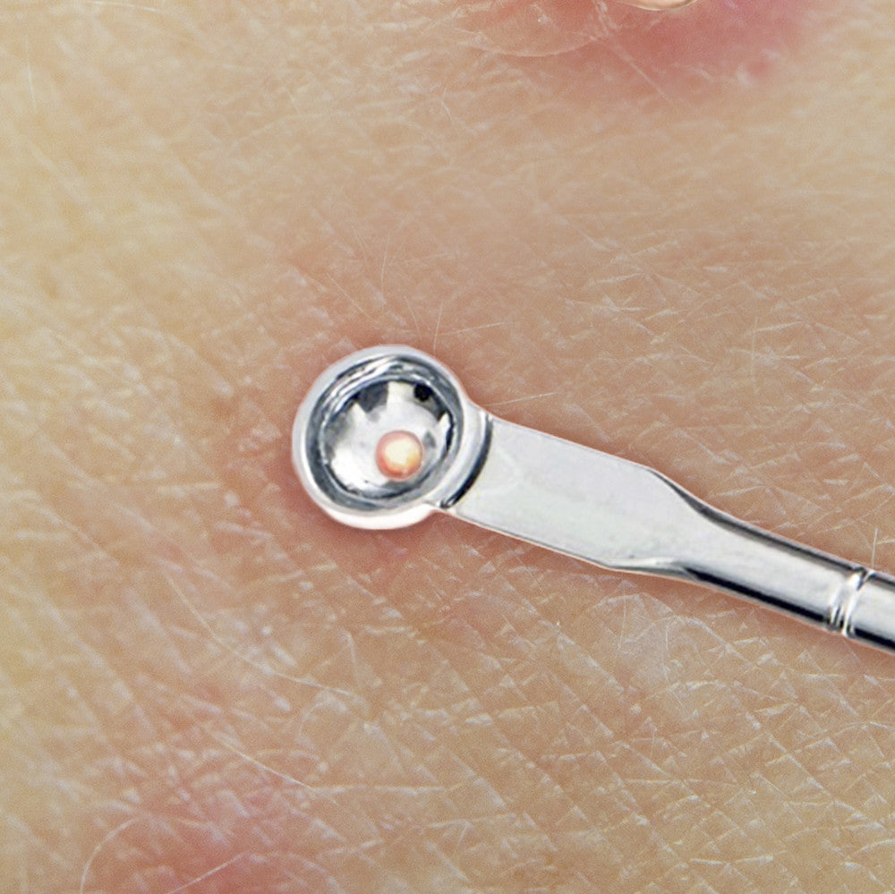 Blackhead Remover Pimple Extractor Tool for Acne & Blemish Removal