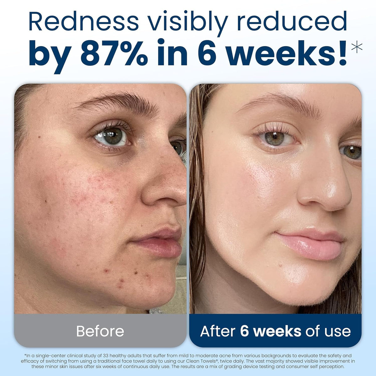 Disposable Face Towels Biobased Makeup Remover Wipes for Sensitive Skin