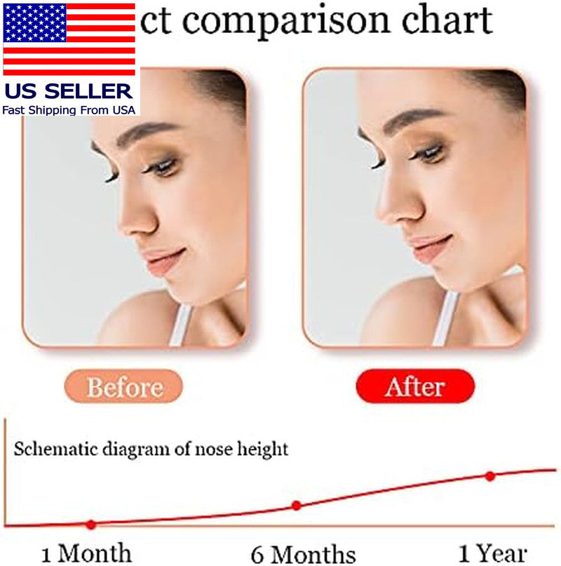 Nose Shaper Lifter Clip for Wide Noses - Reshape & Straighten