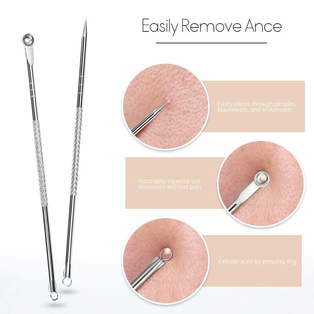 Pimple Popper & Blackhead Extractor Tool Kit for Face & Nose Skin Care