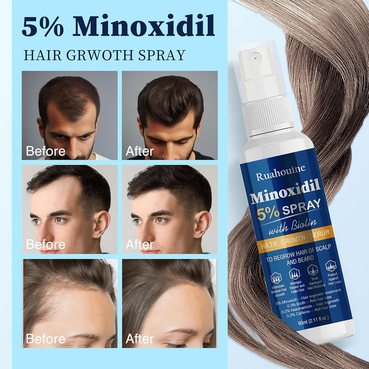 Hair Regrowth Treatment Spray with 5% Minoxidil – Strengthens &