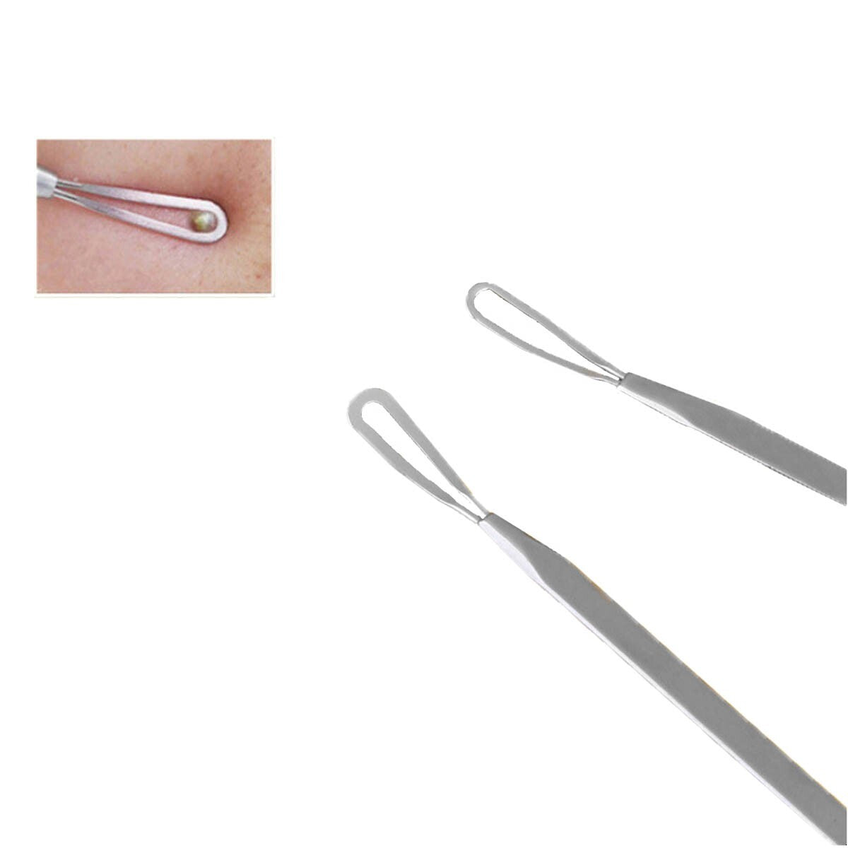 9-Piece Blackhead Acne Extractor Kit - Professional Pimple Popping Tools