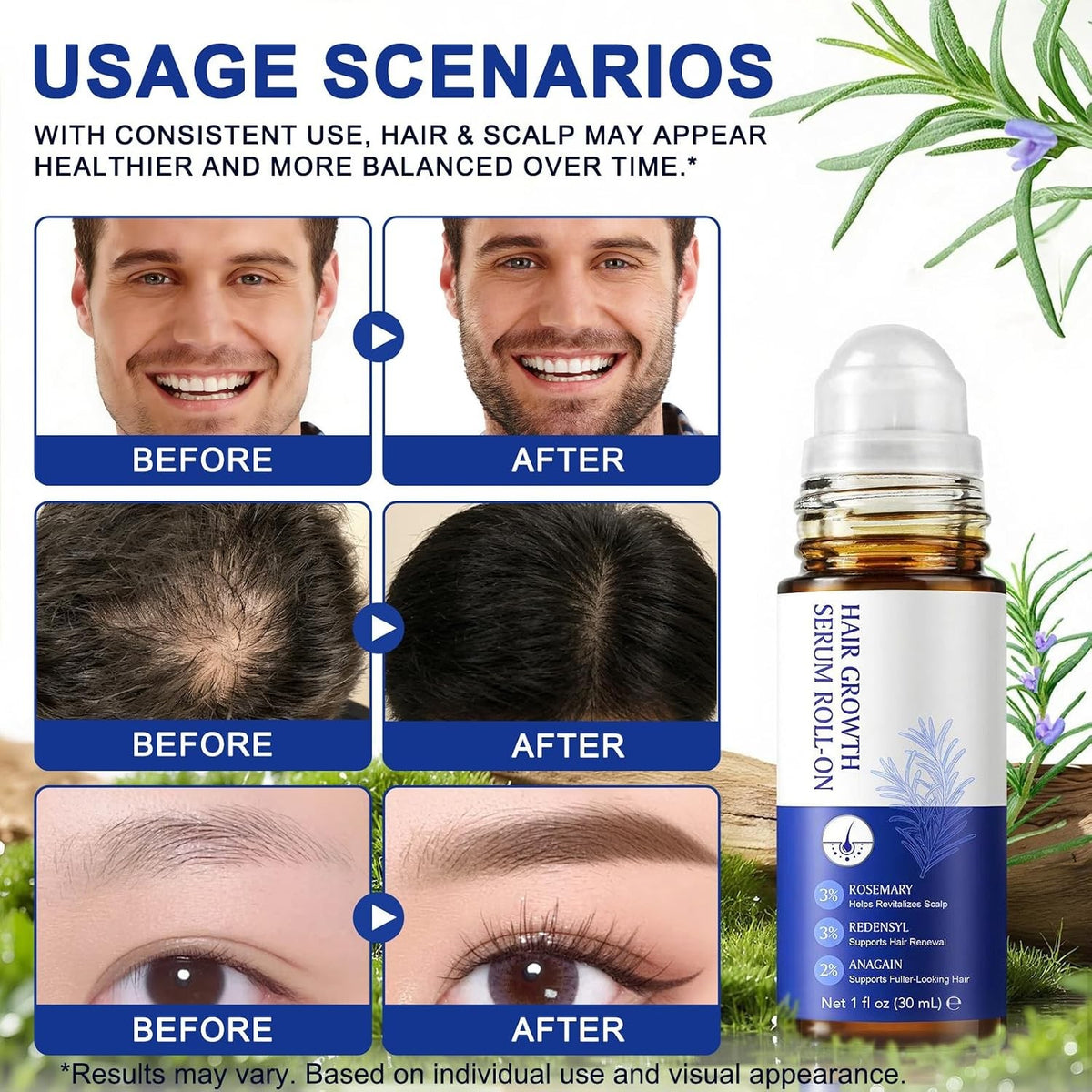 Hair Growth Serum Roll On, 30ml Oil with 3% Rosemary, Redensyl, 2