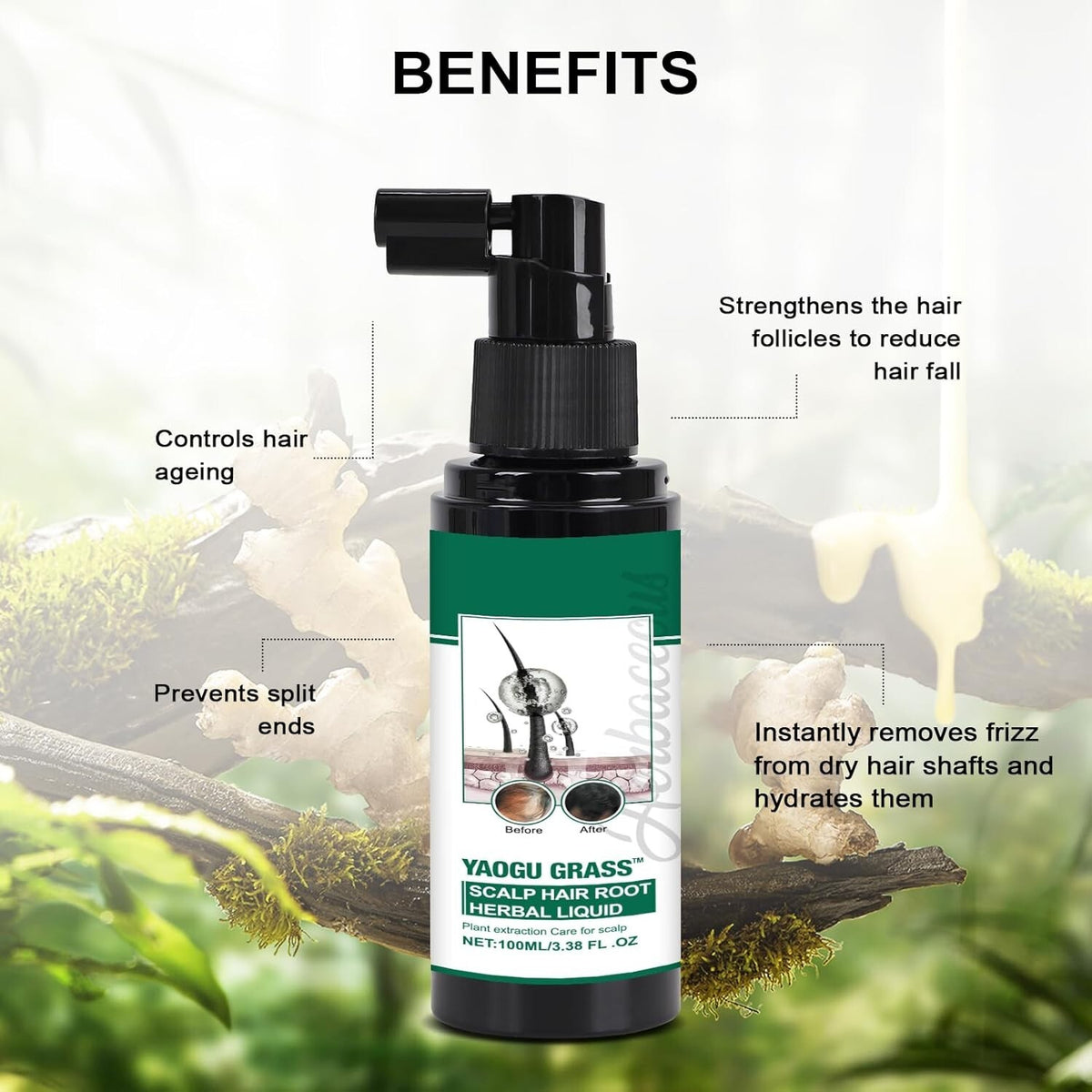 Scalp Treatment Serum for Hair Growth & Anti-Dandruff Relief