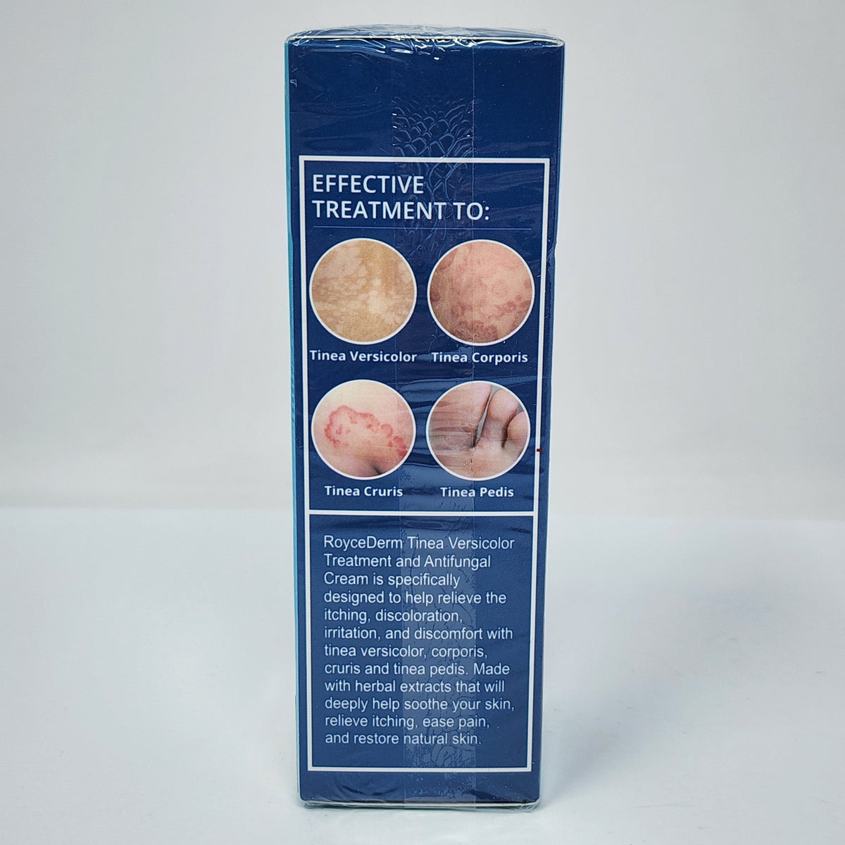 Antifungal Cream for Tinea Versicolor & Pedis 2 oz - Fungal Skin Treatment